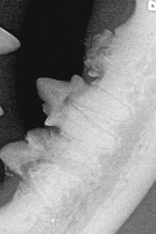 Im Röntgenbild zeigt sich deutlich, wie die Krankheit FORL Zahnwurzel sowie Zahnkrone zersetzt hat